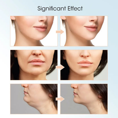 LumiLift Pro V-Face Massager